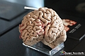 VBS_2946 - Cervello. Morbo di Alzheimer - Mostra Body Worlds